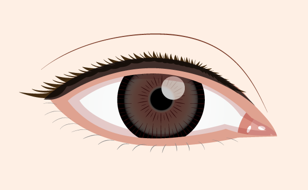 眼瞼手術